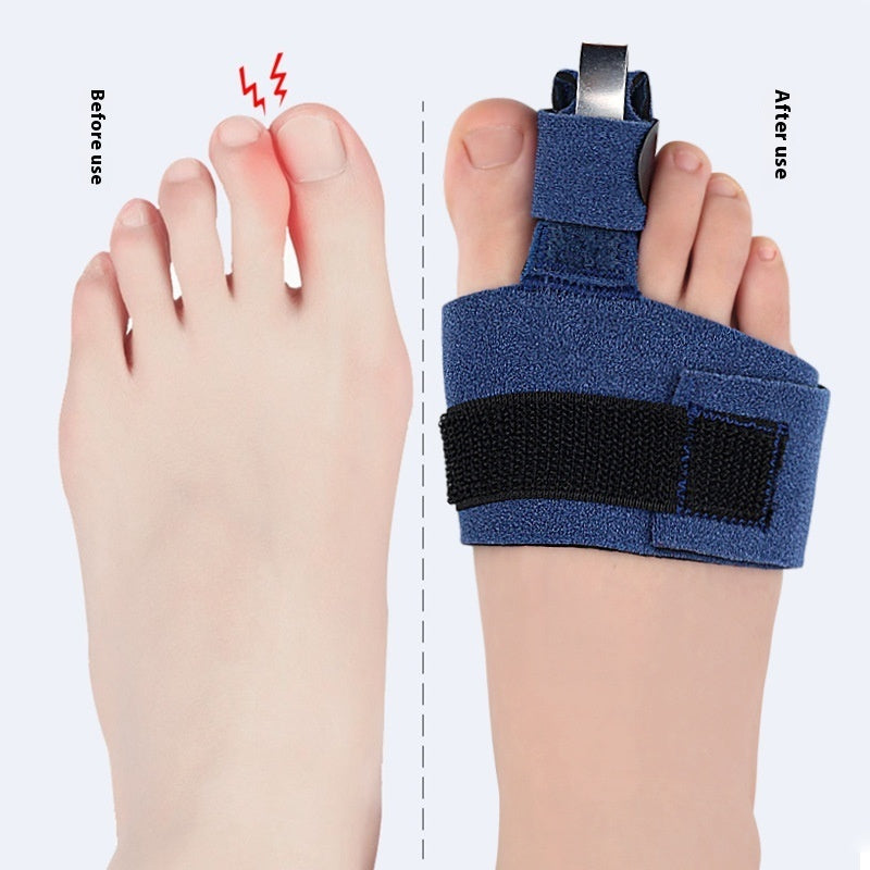 Toe Fixing Band Adjustable Fixed Splint Single Finger Curved Bow Aluminum Plate Support Protective Gear Toe Protective Cover