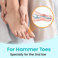 Hallux Valgus Overlapping Support Splint Strap Fixing