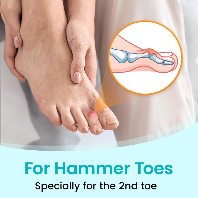 Hallux Valgus Overlapping Support Splint Strap Fixing
