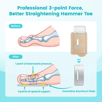 Hallux Valgus Overlapping Support Splint Strap Fixing
